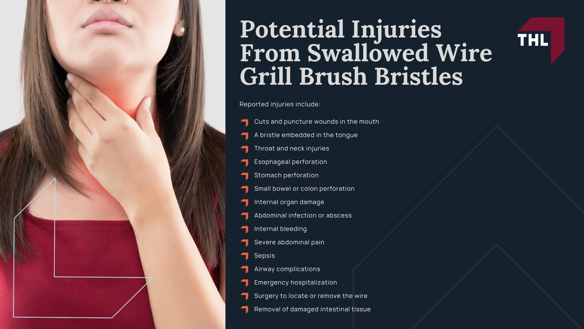 What Is the Cuisinart Grill Brush Lawsuit About; Conair Recalled 1.7 Million Cuisinart Grill Brushes; Why Were Cuisinart Grill Brushes Recalled; Which Cuisinart Grill Brush Models and Tool Sets Were Recalled; How to Identify a Recalled Cuisinart Grill Brush; What Consumers Should Do With a Recalled Cuisinart Grill Brush; How Cuisinart Grill Brush Bristles Can Contaminate Food; What Happens After a Grill Brush Bristle Is Swallowed; Potential Injuries From Swallowed Wire Grill Brush Bristles