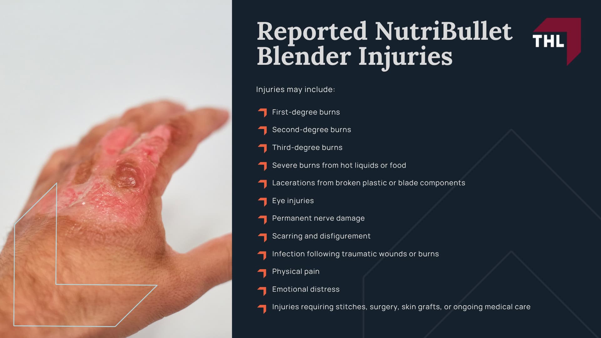 NutriBullet Lawsuit Investigation_ Overview; Why the NutriBullet Model Matters; Why NutriBullet Blenders May Pose an Injury Risk; Reported NutriBullet Blender Injuries
