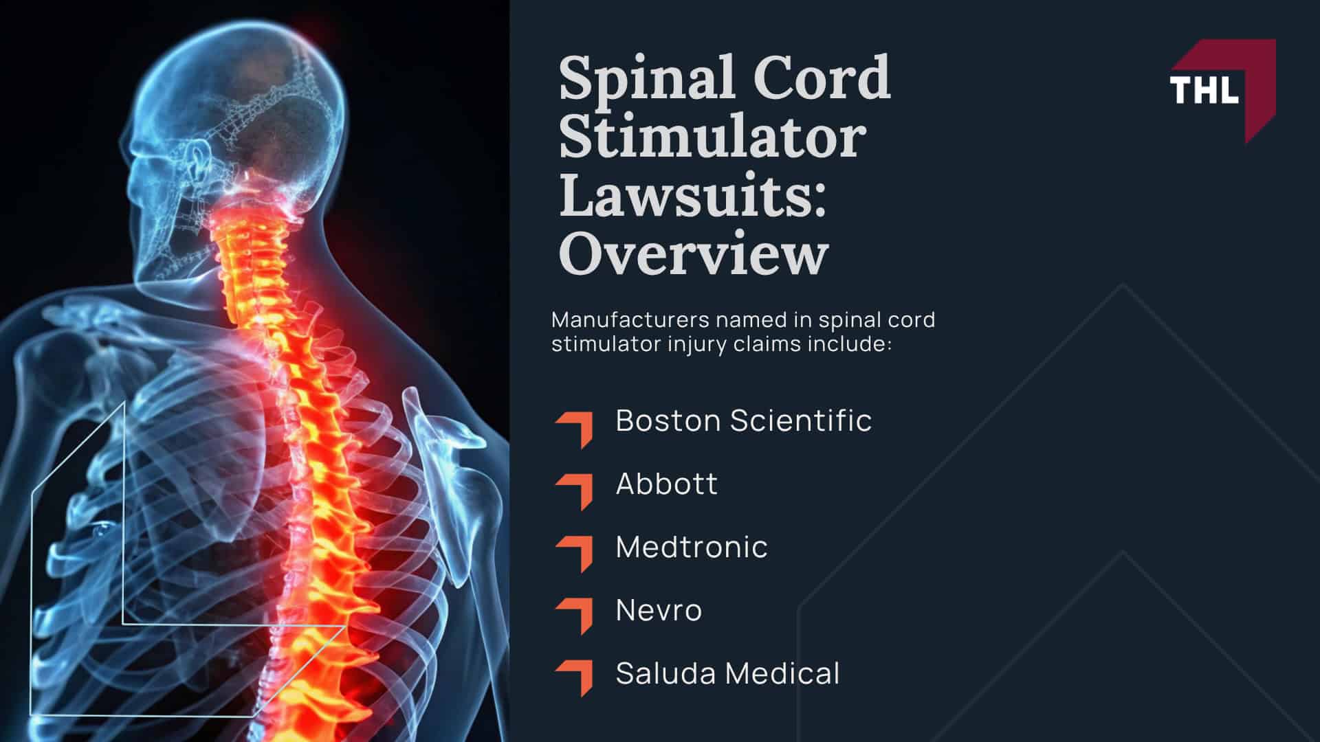 What Is Spinal Cord Stimulator Overstimulation; Common Symptoms of Spinal Cord Stimulator Overstimulation; When Are Overstimulation Symptoms a Warning Sign of Bigger Problems; What Causes Spinal Cord Stimulator Overstimulation; What Is Spinal Cord Stimulator Overstimulation; Common Symptoms of Spinal Cord Stimulator Overstimulation; When Are Overstimulation Symptoms a Warning Sign of Bigger Problems; What Causes Spinal Cord Stimulator Overstimulation; Spinal Cord Stimulator Lawsuits_ Overview