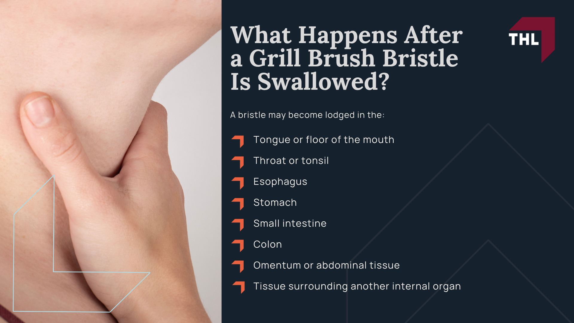 What Is the Cuisinart Grill Brush Lawsuit About; Conair Recalled 1.7 Million Cuisinart Grill Brushes; Why Were Cuisinart Grill Brushes Recalled; Which Cuisinart Grill Brush Models and Tool Sets Were Recalled; How to Identify a Recalled Cuisinart Grill Brush; What Consumers Should Do With a Recalled Cuisinart Grill Brush; How Cuisinart Grill Brush Bristles Can Contaminate Food; What Happens After a Grill Brush Bristle Is Swallowed