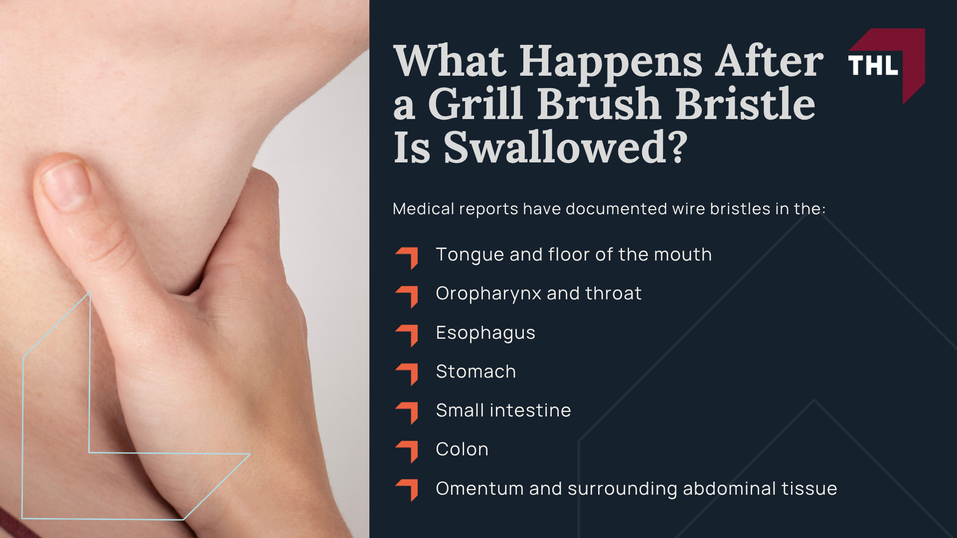 What Is the Nexgrill Brush Lawsuit About; Nexgrill Recalled 10.2 Million Metal Wire Bristle Grill Brushes;  Which Nexgrill Grill Brush Models Were Recalled; What Consumers Should Do If They Own a Recalled Nexgrill Brush; How the Nexgrill Recall Refund Process Works; Why Detached Nexgrill Grill Brush Bristles Can Cause Serious Injuries; What Happens After a Grill Brush Bristle Is Swallowed