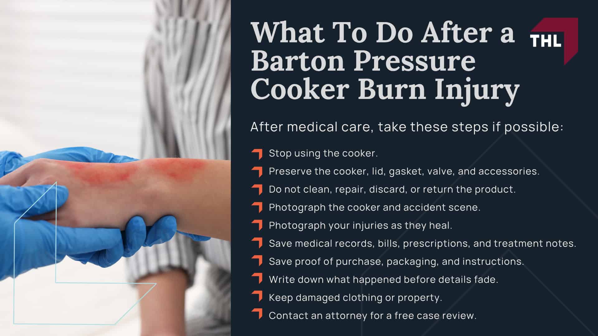 What Is the Barton Pressure Cooker Lawsuit Investigation; Why Barton Pressure Cookers May Pose a Burn Risk; Lawsuits Filed Over Barton Pressure Cooker Injuries; Who Can File a Barton Pressure Cooker Lawsuit; Evidence Needed for a Barton Pressure Cooker Burn Claim; Damages in a Barton Pressure Cooker Lawsuit; What To Do After a Barton Pressure Cooker Burn Injury