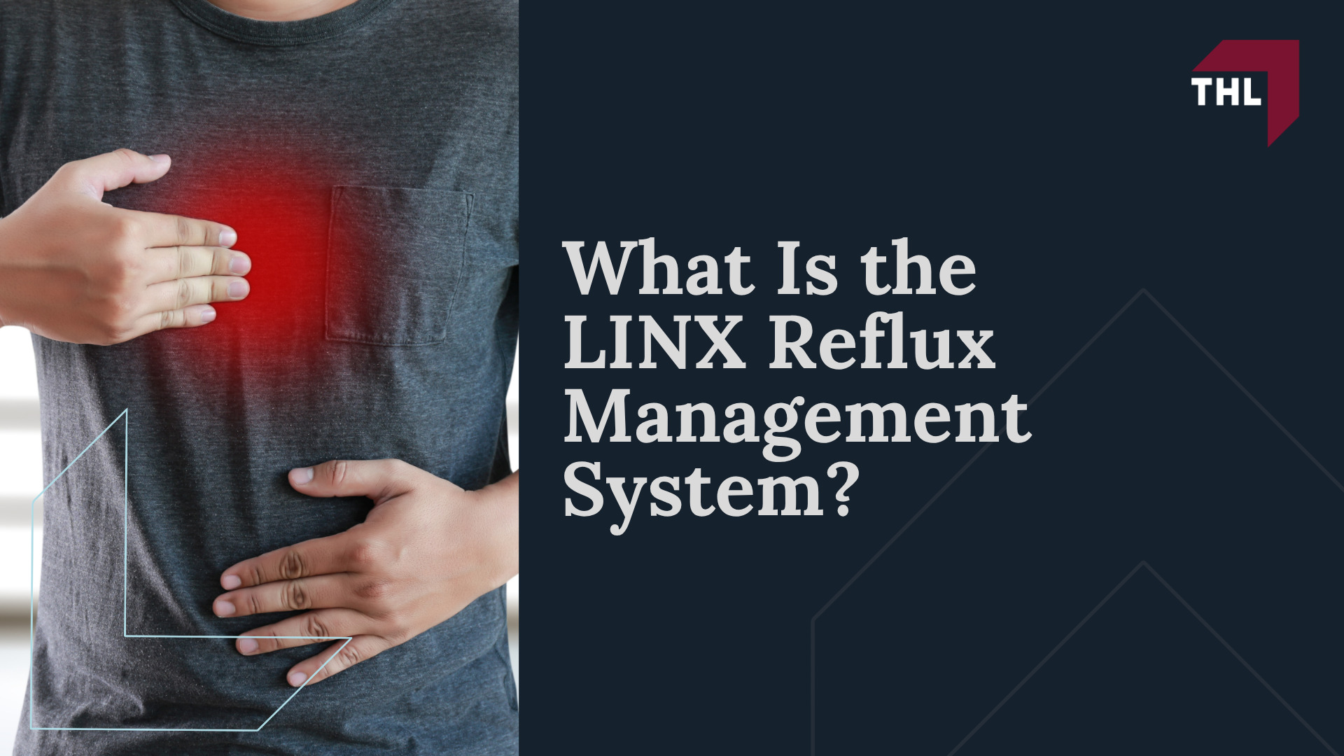 LINX Reflux Device Lawsuit Overview; LINX Device Complications and Reported Injuries; Signs That a LINX Reflux Device May Have Failed; What Is the LINX Reflux Management System