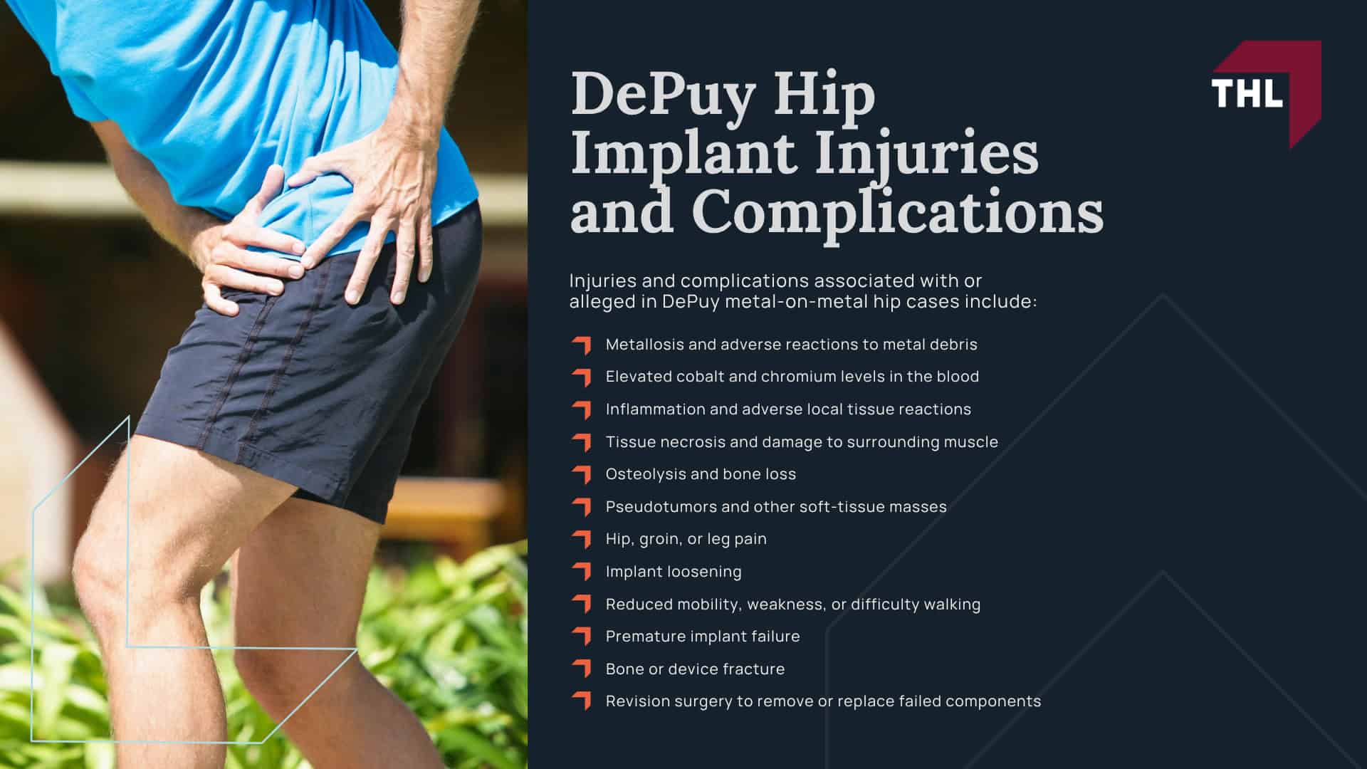 DePuy Hip Lawsuit Overview; Which DePuy Hip Implants Are Involved in Lawsuits; DePuy Hip Implant Injuries and Complications
