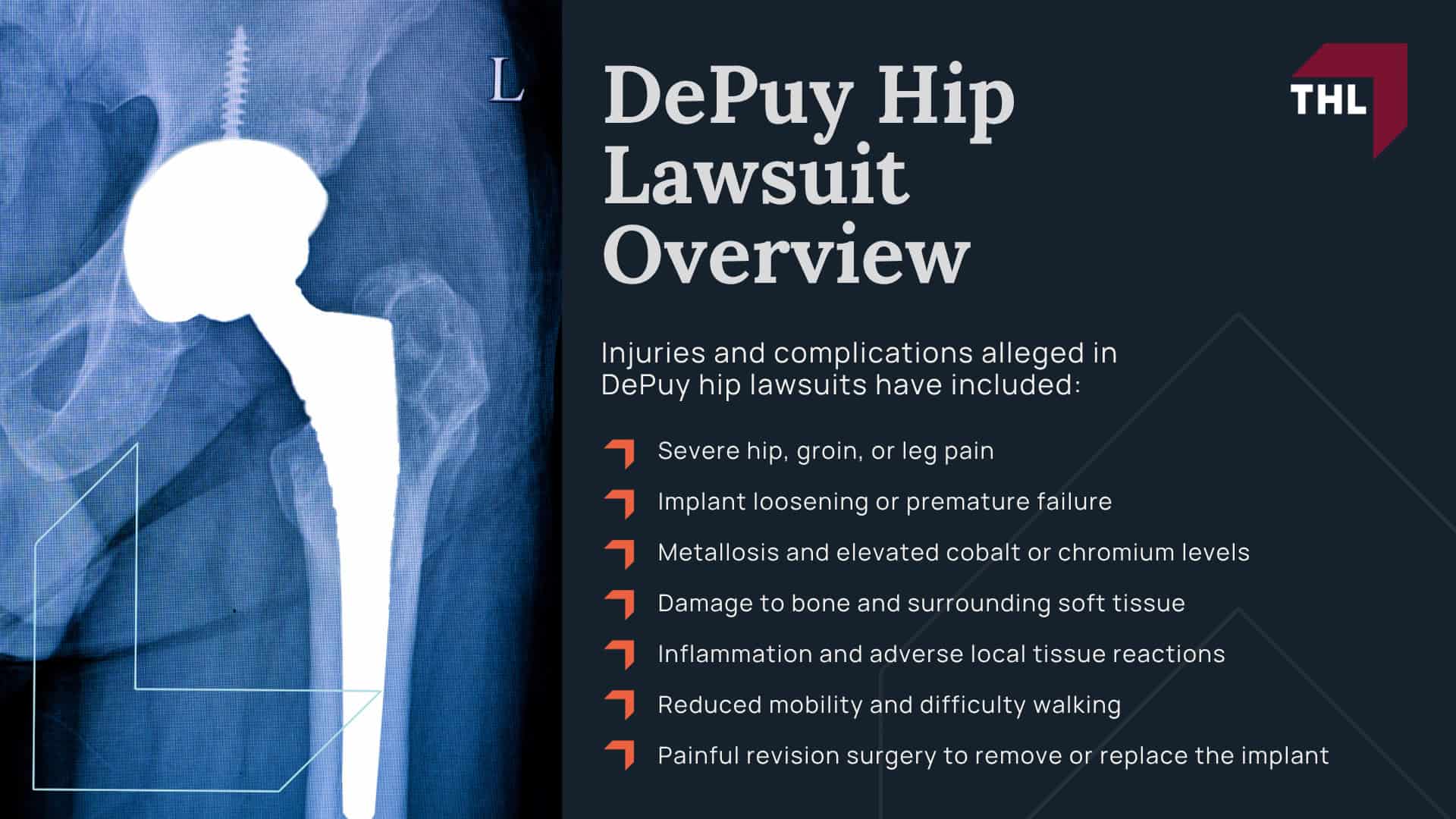 DePuy Hip Lawsuit Overview