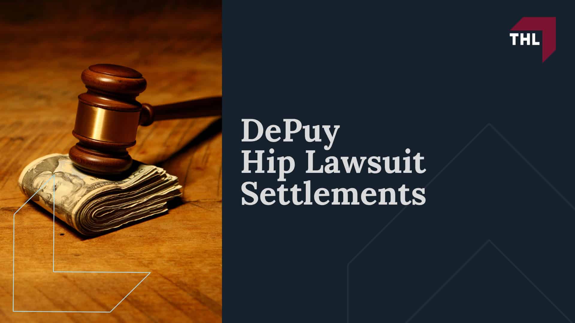 DePuy Hip Lawsuit Overview; Which DePuy Hip Implants Are Involved in Lawsuits; DePuy Hip Implant Injuries and Complications; DePuy Hip Lawsuit Settlements