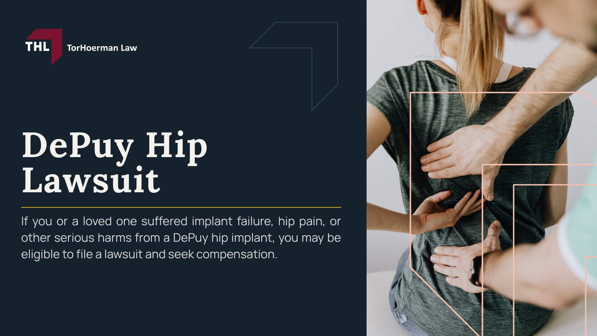 DePuy Hip Lawsuit; DePuy Hip Lawsuit Overview; Which DePuy Hip Implants Are Involved in Lawsuits; DePuy Hip Implant Injuries and Complications; DePuy Hip Lawsuit Settlements; DePuy Hip Lawsuit Verdicts; Who May Qualify to File a DePuy Hip Lawsuit; Evidence in DePuy Hip Replacement Lawsuits; Potential Compensation in DePuy Hip Replacement Lawsuits; Contact TorHoerman Law_ Investigating DePuy Hip Replacement Claims