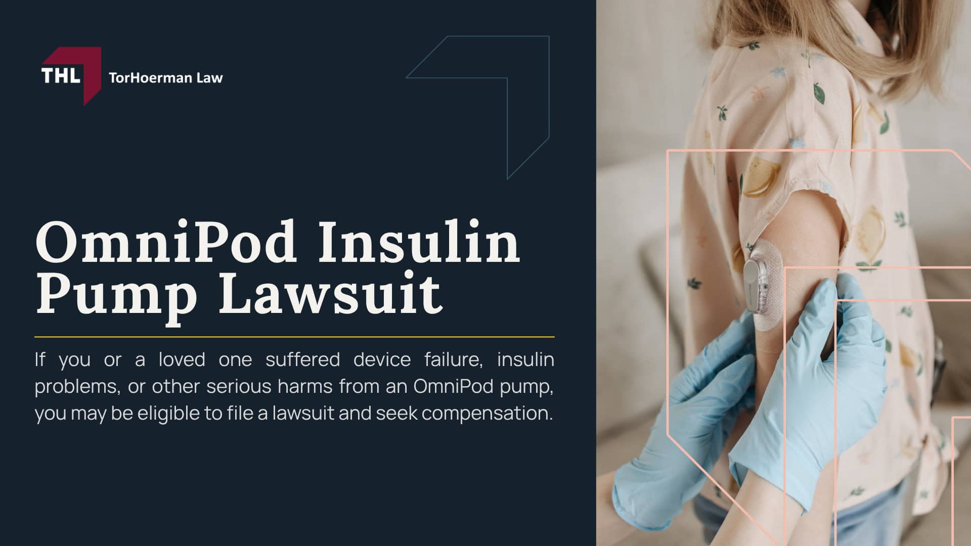 OmniPod Insulin Pump Lawsuit