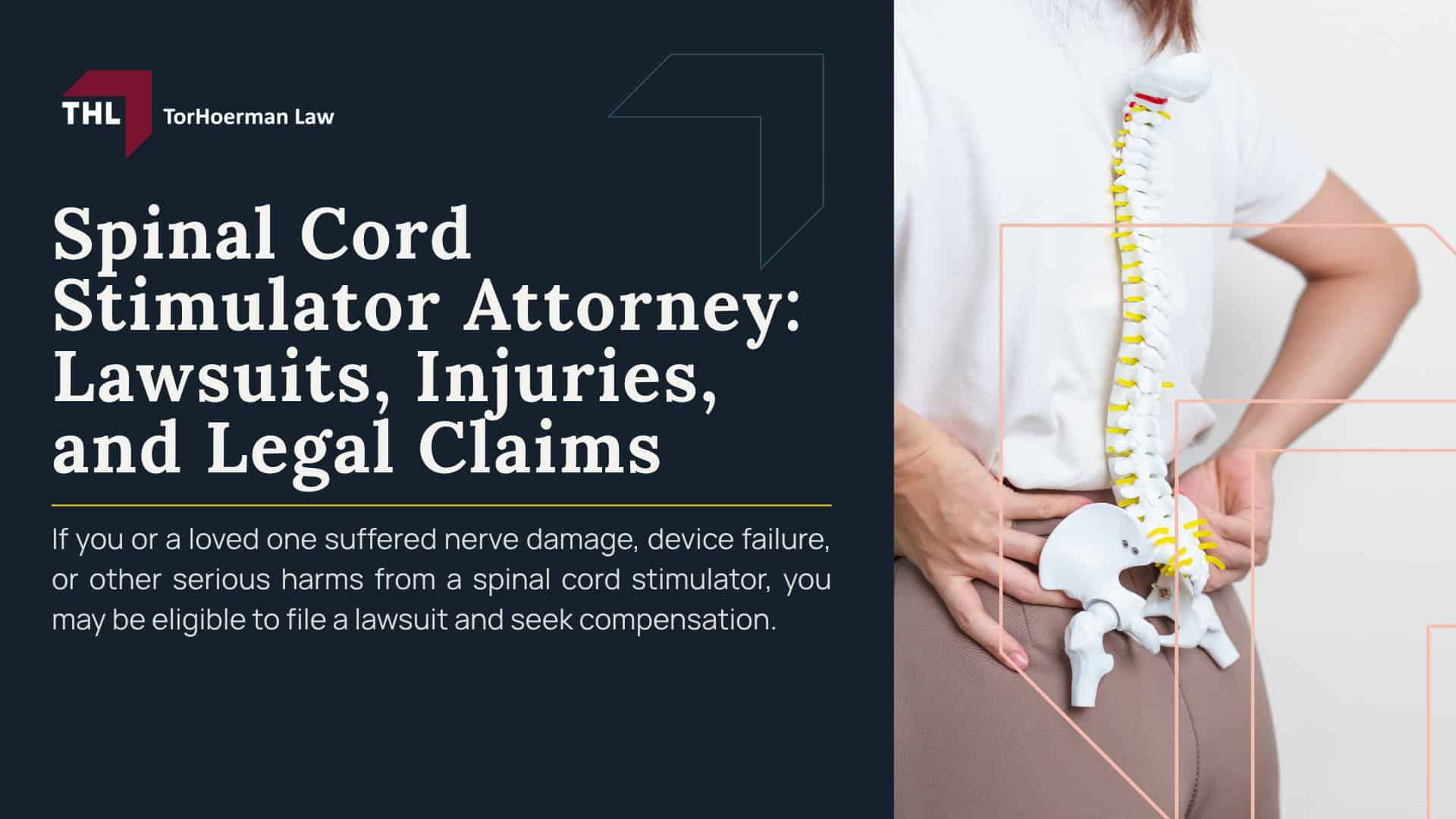 Spinal Cord Stimulator Attorney Lawsuits, Injuries, and Legal Claims