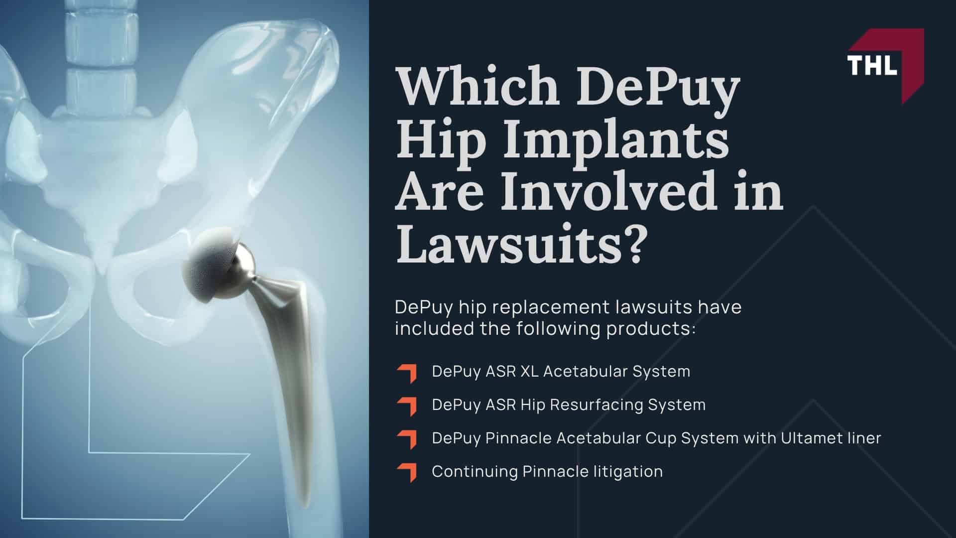 DePuy Hip Lawsuit Overview; Which DePuy Hip Implants Are Involved in Lawsuits