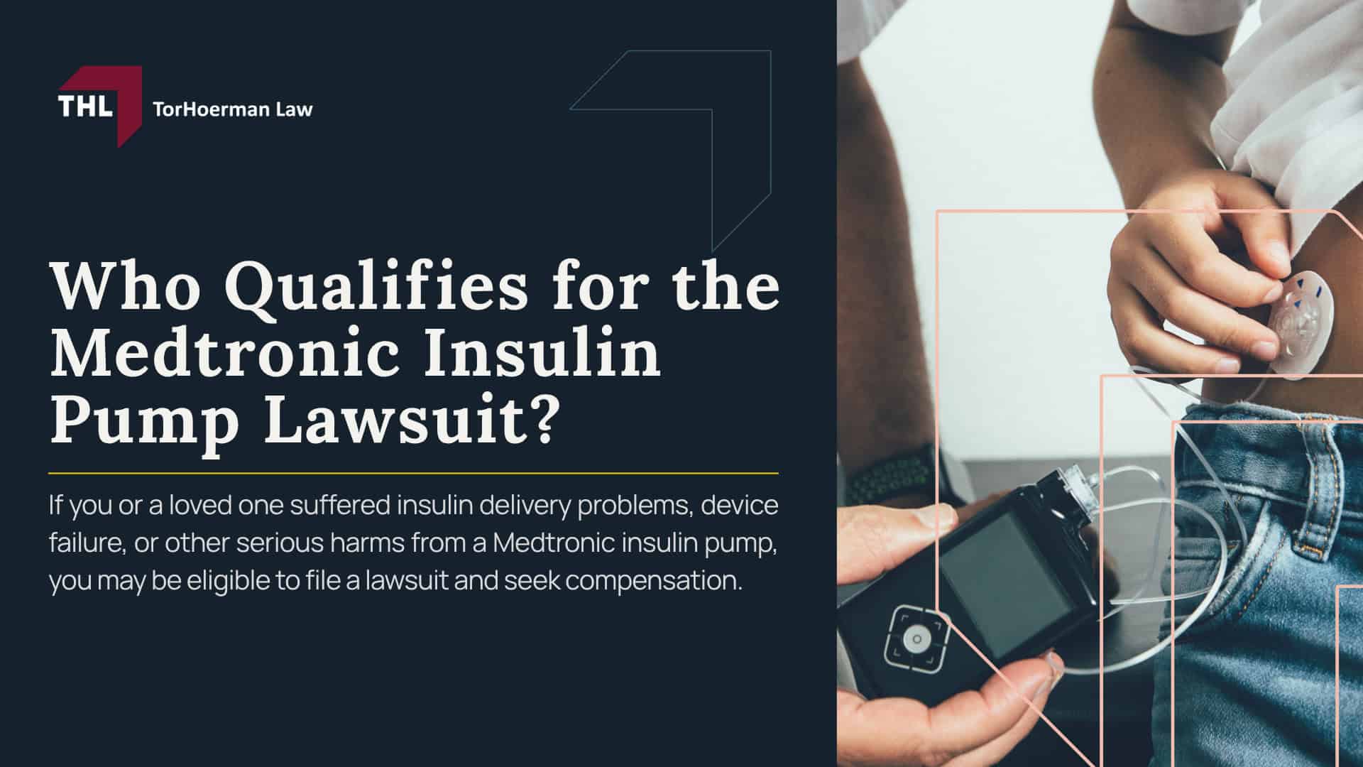 Who Qualifies for the Medtronic Insulin Pump Lawsuit