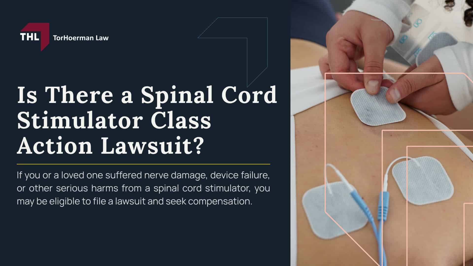 Is There a Spinal Cord Stimulator Class Action Lawsuit