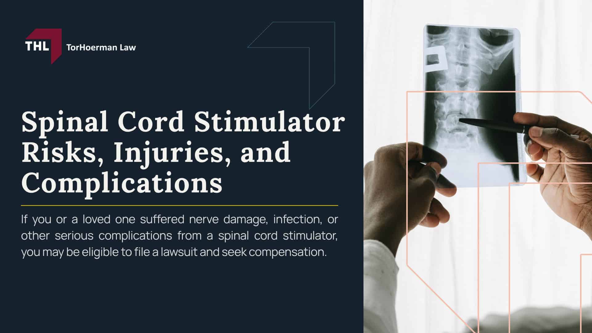 Spinal Cord Stimulator Risks, Injuries, and Complications